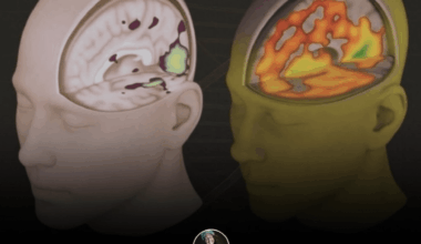 Štúdia MIT Media Lab použila EEG skeny mozgu používateľov AI pri písaní eseje