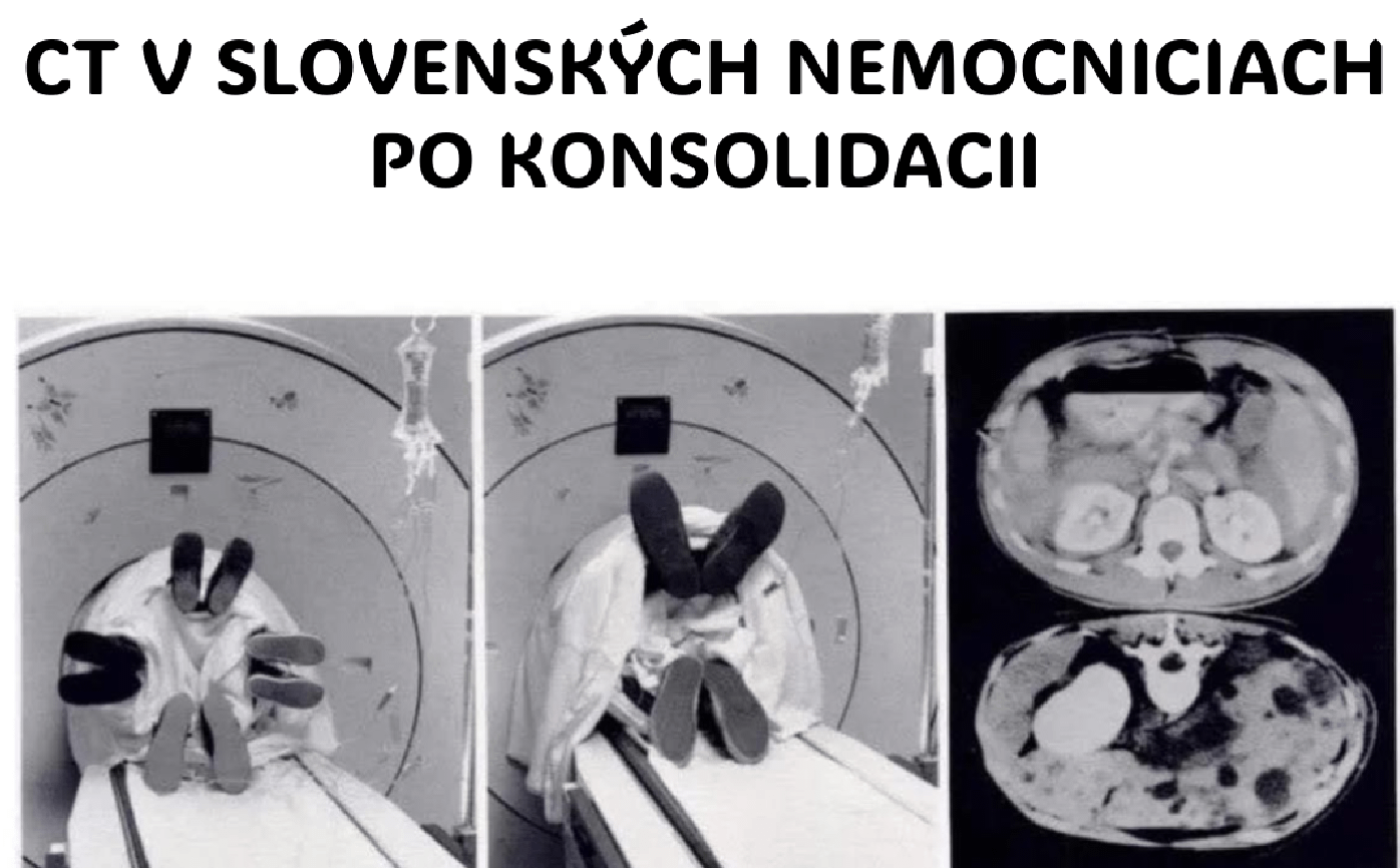 CT po slovensky