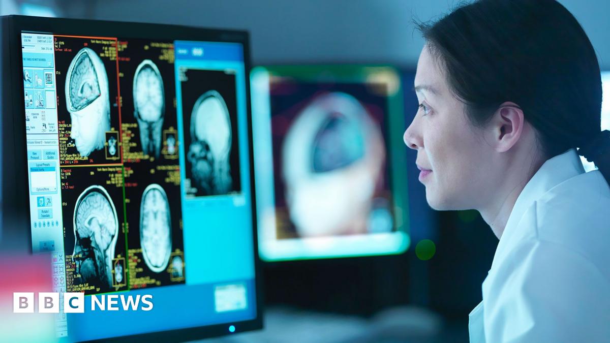 Menopause linked to Alzheimer's-like brain changes