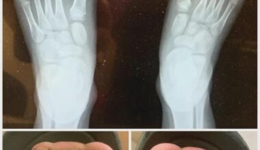 Meie kallid lõunanaabrid!