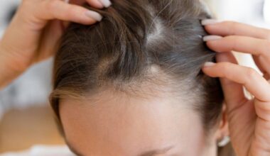 UK judge rules that baldness is a disability in tax row with wig makers | The groundbreaking judgement found that severe hair loss can ‘adversely affect’ the ability to carry out everyday activities