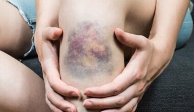 Ecchymoses, morsures, pincements... le calvaire d'un enfant de 4 ans raconté au palais de justice de Nantes