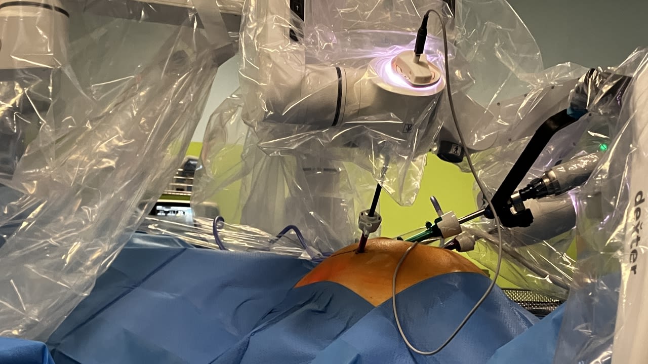 Le robot est installé de part et d’autre du patient. Ses deux bras articulés équipés de pinces sont contrôlés à distance par le chirurgien.