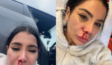 « J’étais en boule par terre, elle a frappé » : une influenceuse rouée de coups pour un accrochage futile au volant