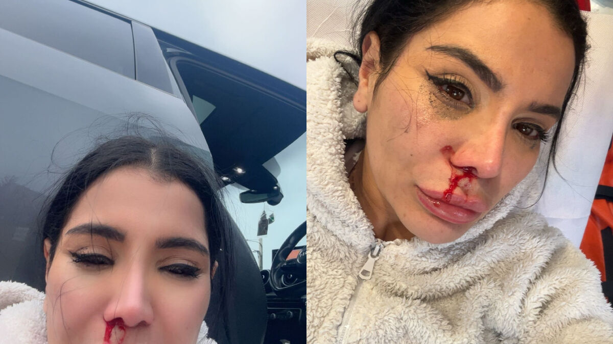 « J’étais en boule par terre, elle a frappé » : une influenceuse rouée de coups pour un accrochage futile au volant