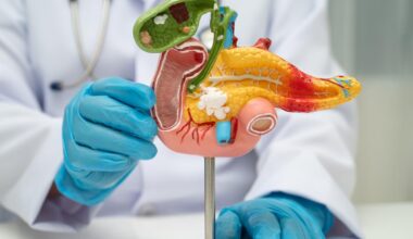 Les scientifiques ont découvert un point faible du cancer du pancréas et (enfin) une piste de traitement