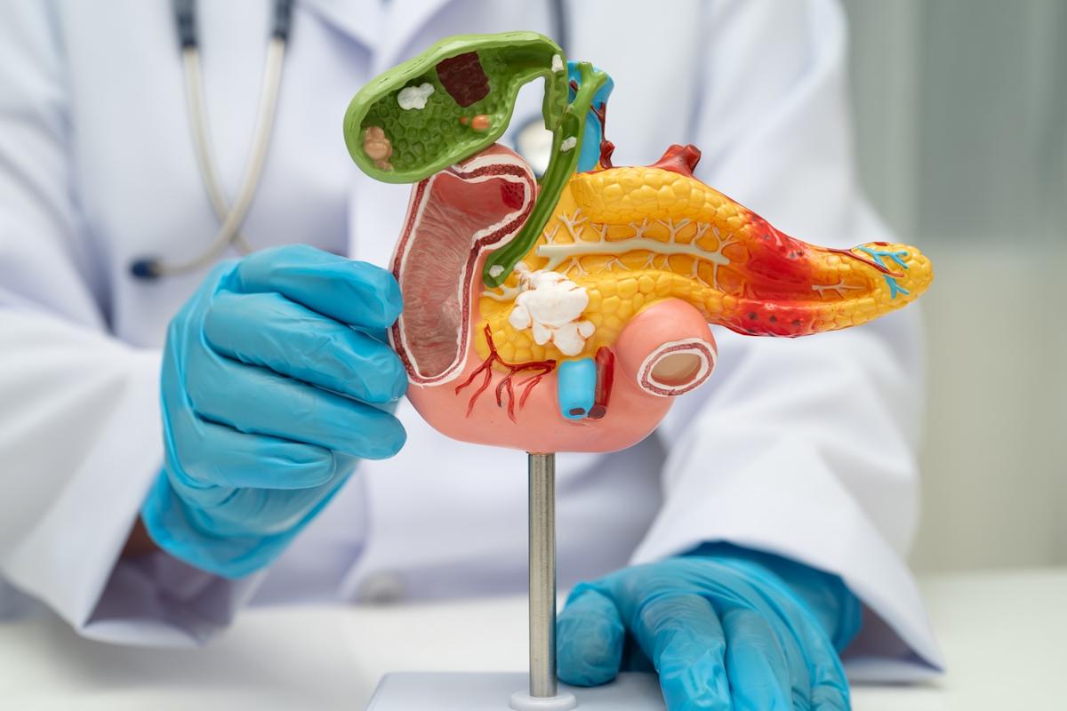 Les scientifiques ont découvert un point faible du cancer du pancréas et (enfin) une piste de traitement