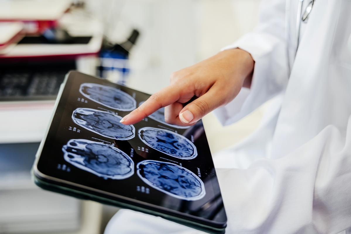 Attention, ces signes subtils peuvent révéler que vous souffrez d'une maladie cérébrale non diagnostiquée