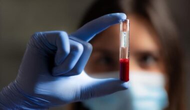 Cancer : NovaGray évalue la tolérance à la radiothérapie avec une simple prise de sang