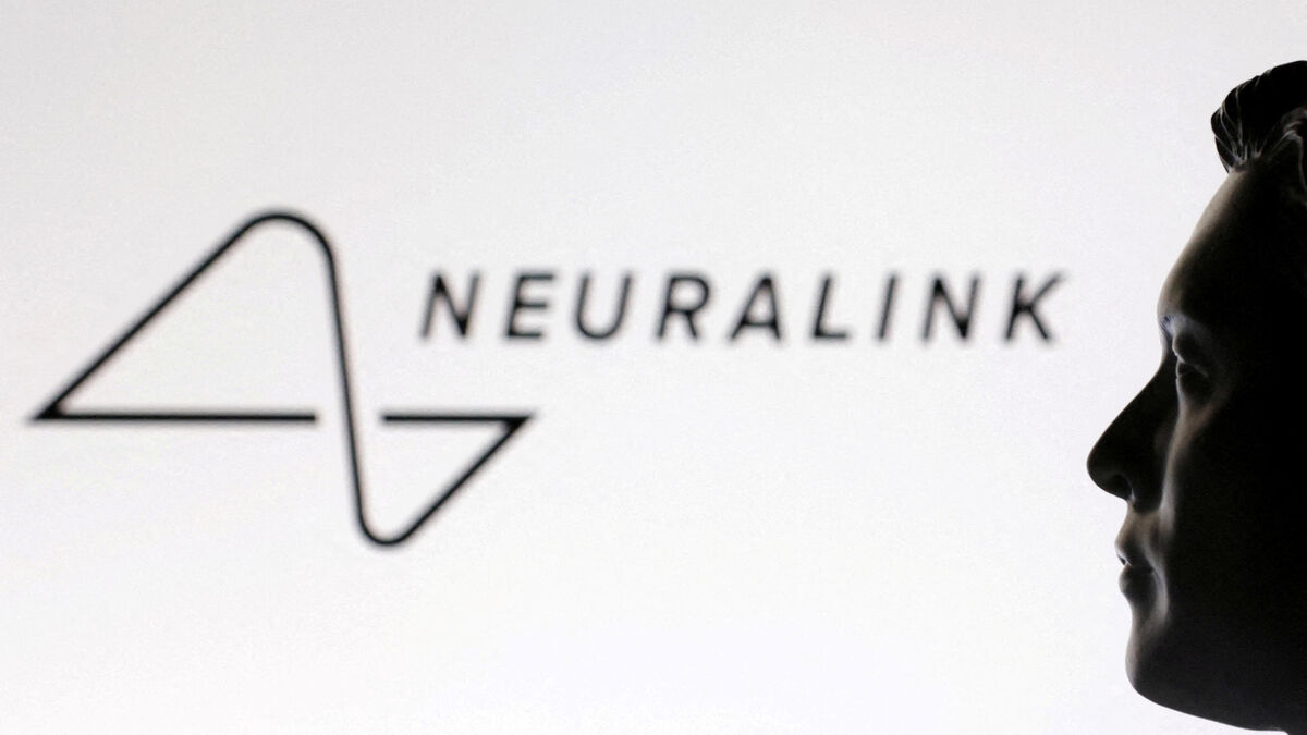 « J’écris ceci avec mon cerveau » : un bénéficiaire de Neuralink raconte sur X comment fonctionne son implant