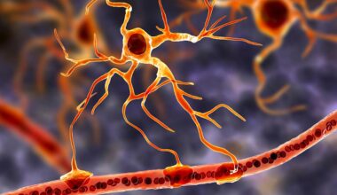 Une cause probable de la maladie de Charcot identifiée par des chercheurs français