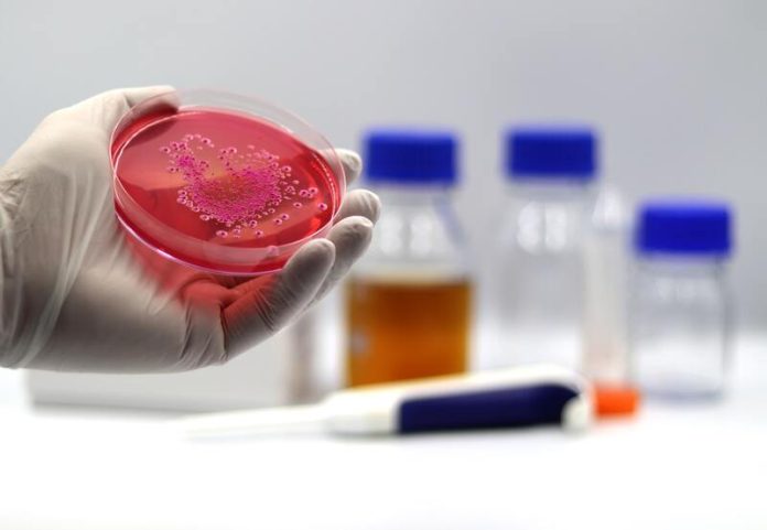 bactérie résistante antibiotiques antibiorésistance europe france alerte Ma Santé Un médecin qui examine les bactéries résistantes aux antibiotiques.