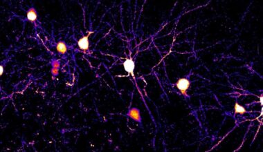 Des chercheurs démontrent la complexité des neurones humains grâce à des découvertes inédites