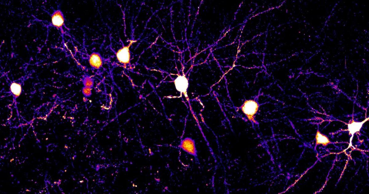Des chercheurs démontrent la complexité des neurones humains grâce à des découvertes inédites