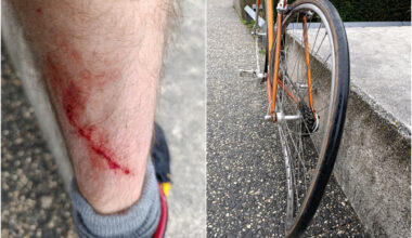 Saint-Etienne. Thomas fauché volontairement à vélo par une voiture : "C'est la 6e agression"