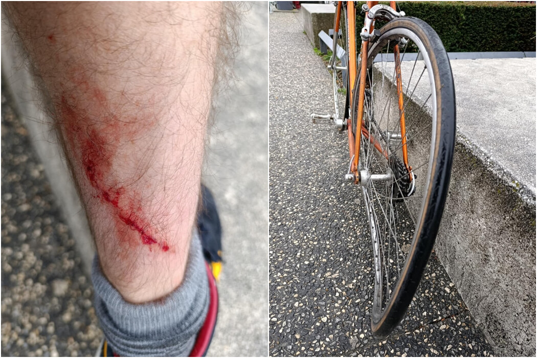 Saint-Etienne. Thomas fauché volontairement à vélo par une voiture : "C'est la 6e agression"