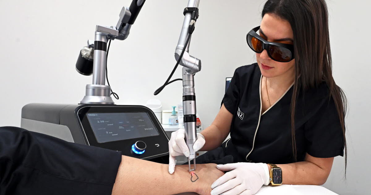 Nancy. Le leader national du détatouage au laser, une technique en plein essor, est Nancéien