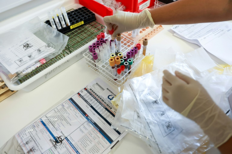Des tests de dépistage du chikungunya réalisés au laboratoire du centre hospitalier universitaire de Saint-Denis, sur l'île de La Réunion, le 10 avril 2025 ( AFP / Richard BOUHET )