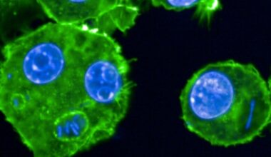 Peste, lèpre... Des chercheurs scrutent les microbes du passé : Actualités