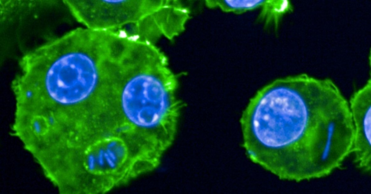 Peste, lèpre... Des chercheurs scrutent les microbes du passé : Actualités