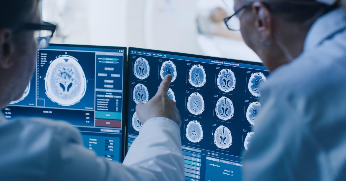 Un traitement par ultrasons testé avec succès contre la dépression résistante
