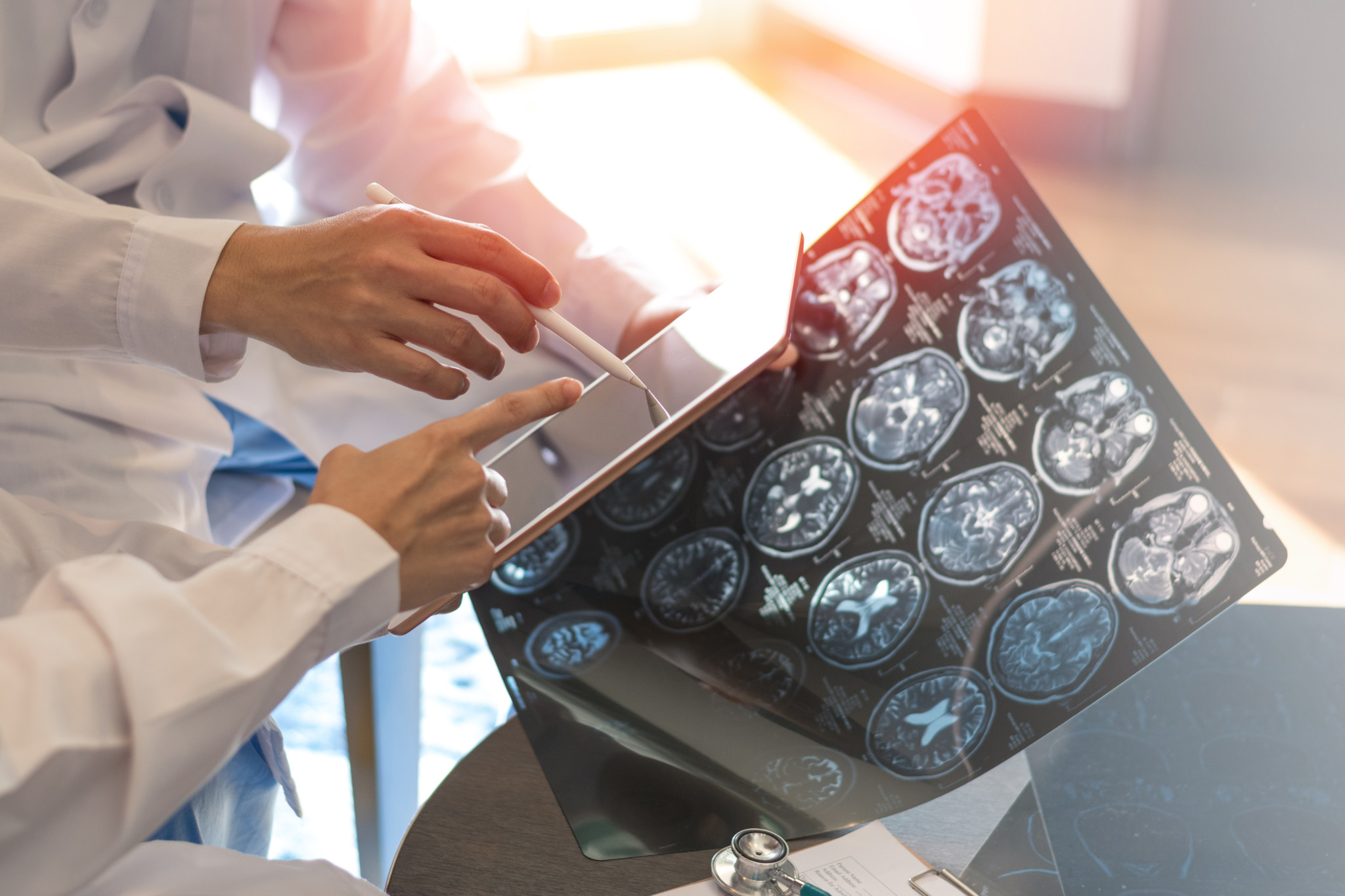 Des radiologistes examinent une IRM cérébrale numérique pour l’oncologie dans une clinique.