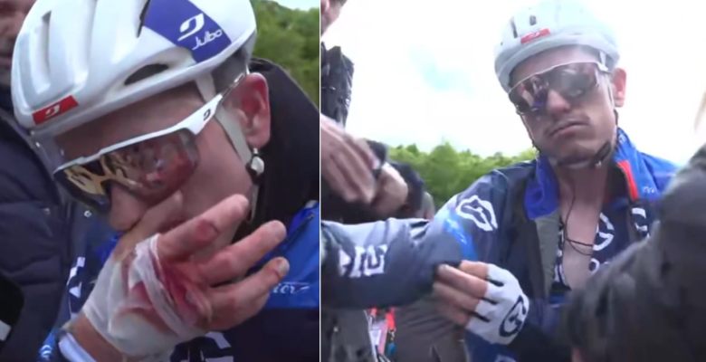Giro. Tour d'Italie - David Gaudu, fortement touché : «On voit le tendon...»