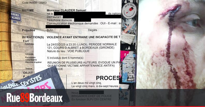Une enquête ouverte après l'agression d'un journaliste de Rue89 Bordeaux par un groupe d'extrême droite