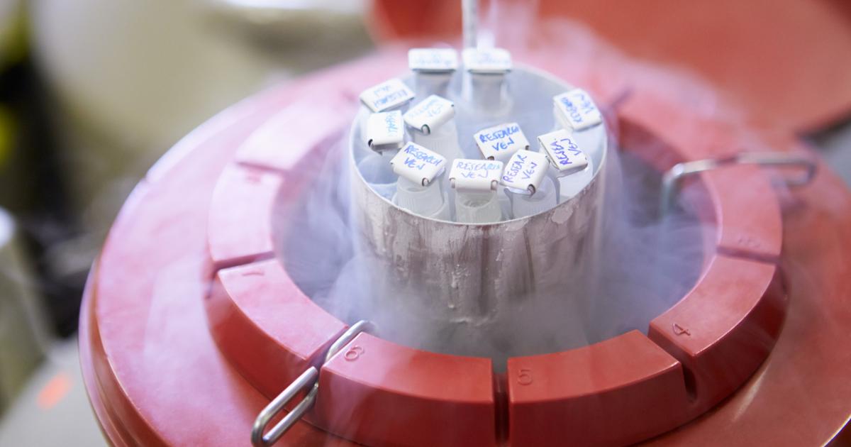 Comment un donneur de sperme a transmis un gène prédisposant au cancer à des dizaines d’enfants en Europe