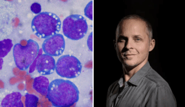 Un chimiste met au point une molécule qui pourrait lutter contre le cancer - LINFO.re