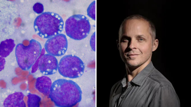 Un chimiste met au point une molécule qui pourrait lutter contre le cancer - LINFO.re