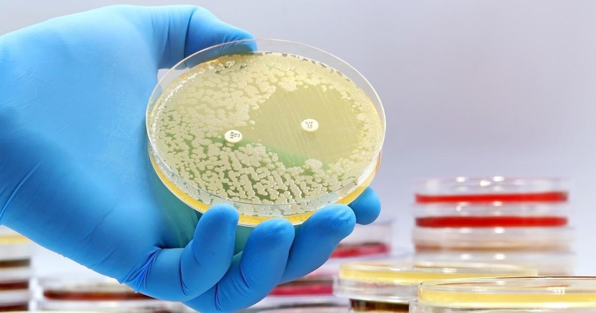 Peste, lèpre... Des chercheurs scrutent les microbes du passé pour comprendre les durées des épidémies