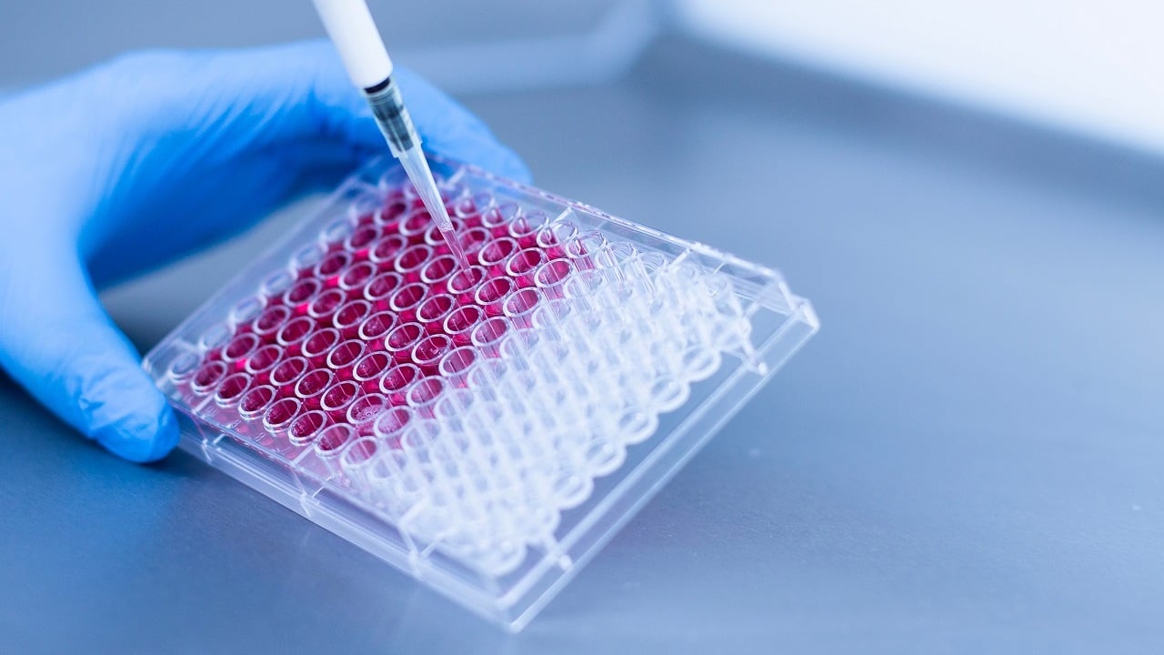 les chercheurs pensent avoir découvert la bactérie coupable de cette épidémie