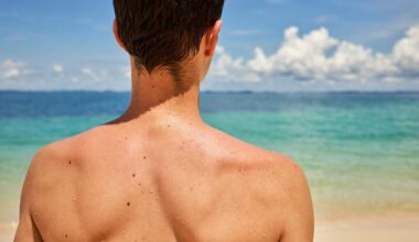 Un dermatologue révèle un signe peu connu du cancer de la peau à prendre très au sérieux