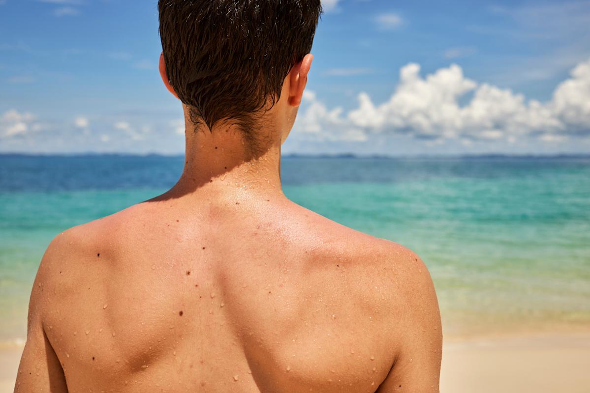Un dermatologue révèle un signe peu connu du cancer de la peau à prendre très au sérieux
