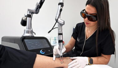 Nancy. Le leader national du détatouage au laser est nancéien
