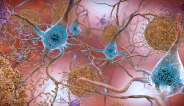 Alzheimer Herpes