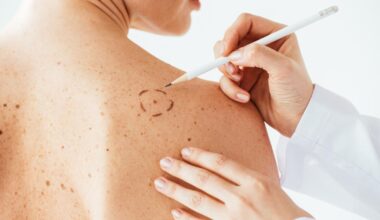 Les œstrogènes peuvent aggraver des cancers jusqu’ici considérés comme non liés aux hormones