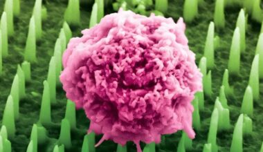 “La fin des biopsies douloureuses” : ce patch aux nanoaiguilles remplace le scalpel pour diagnostiquer un cancer