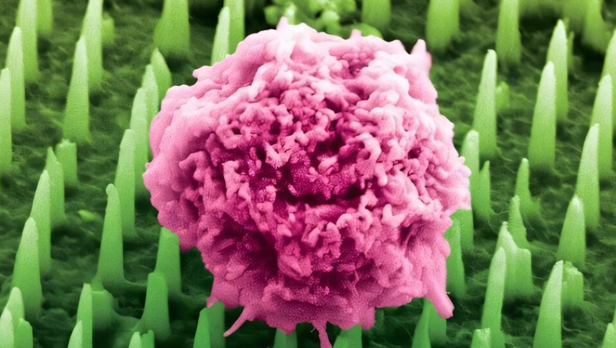 “La fin des biopsies douloureuses” : ce patch aux nanoaiguilles remplace le scalpel pour diagnostiquer un cancer