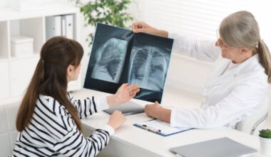 Cancer du poumon : les non-fumeurs sont de plus en plus touchés, en particulier les jeunes femmes et voici pourquoi