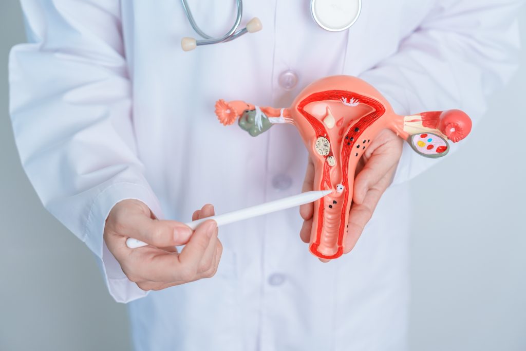 Je pensais être en pleine ménopause, c'était un cancer de l'utérus en phase terminale : voici le symptôme n°1 que j'ai négligé