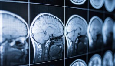 Selon une étude, et si le vieillissement du cerveau était une question de sucre ?