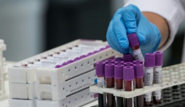 Cancers du sein: une simple prise de sang pour intercepter un début de rechute : Actualités