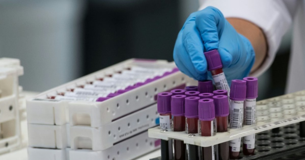 Cancers du sein: une simple prise de sang pour intercepter un début de rechute : Actualités