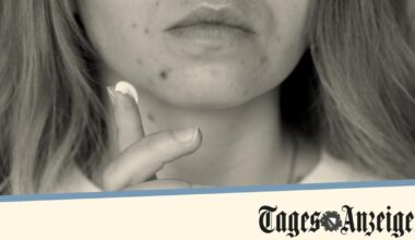 Fausses couches, graves malformations... Ce médicament contre l’acné aux conséquences dramatiques sur les nouveau-nés