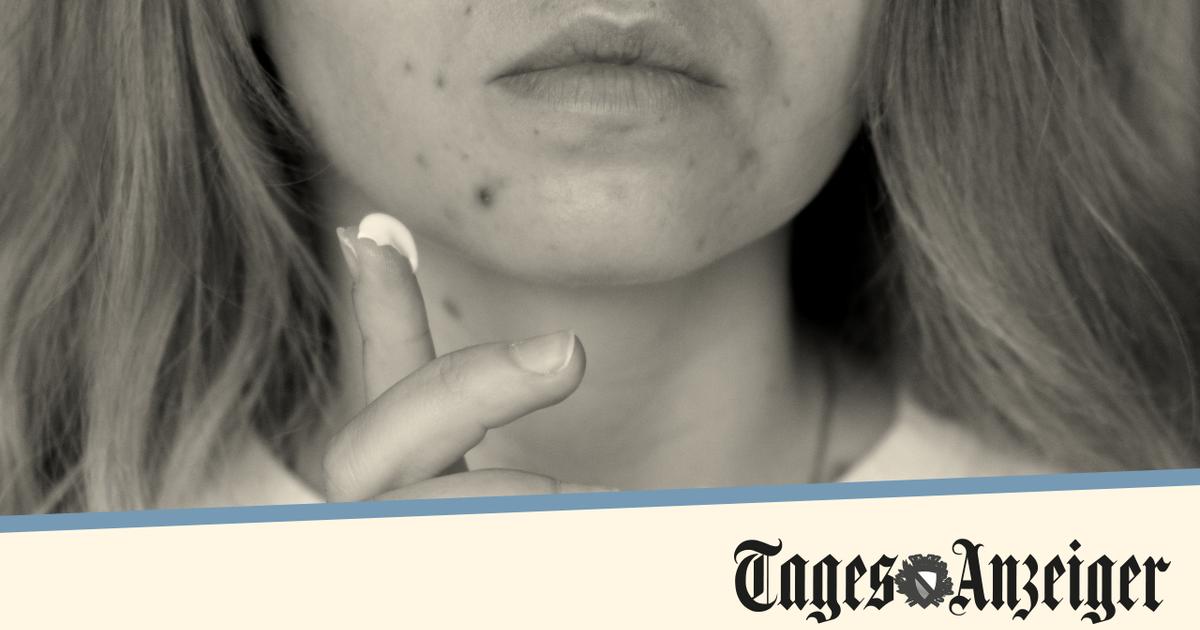 Fausses couches, graves malformations... Ce médicament contre l’acné aux conséquences dramatiques sur les nouveau-nés