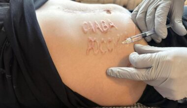 un prisonnier ukrainien mutilé, « Gloire à la Russie » gravé sur son ventre