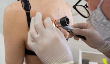 Pourquoi les cas de cancer de la peau ont triplé en France en 30 ans