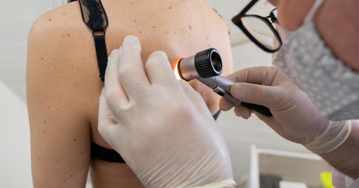 Pourquoi les cas de cancer de la peau ont triplé en France en 30 ans